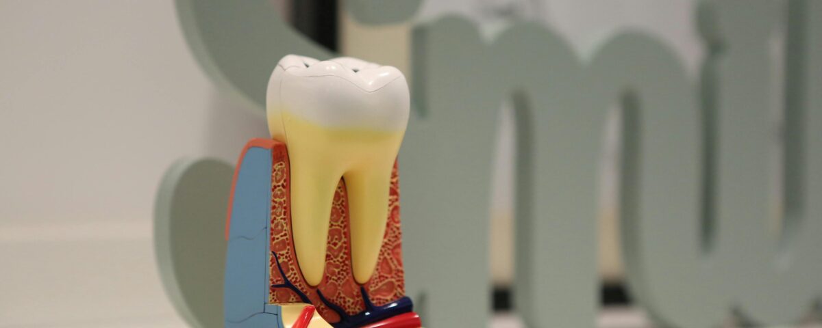 Root Canal Needs Retreatment