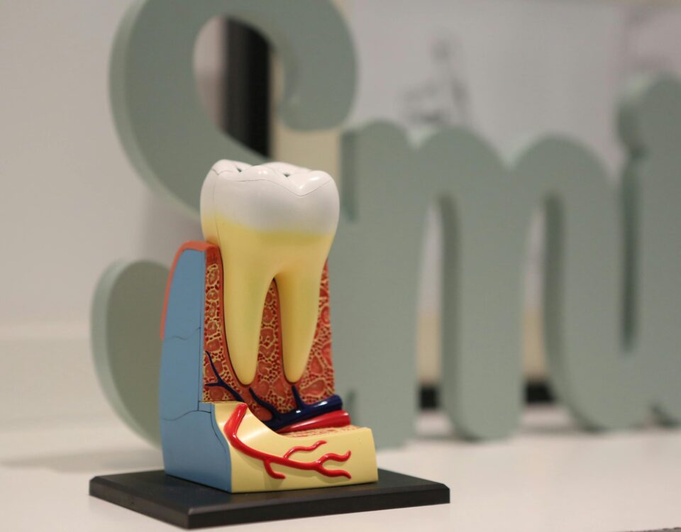 Root Canal Needs Retreatment